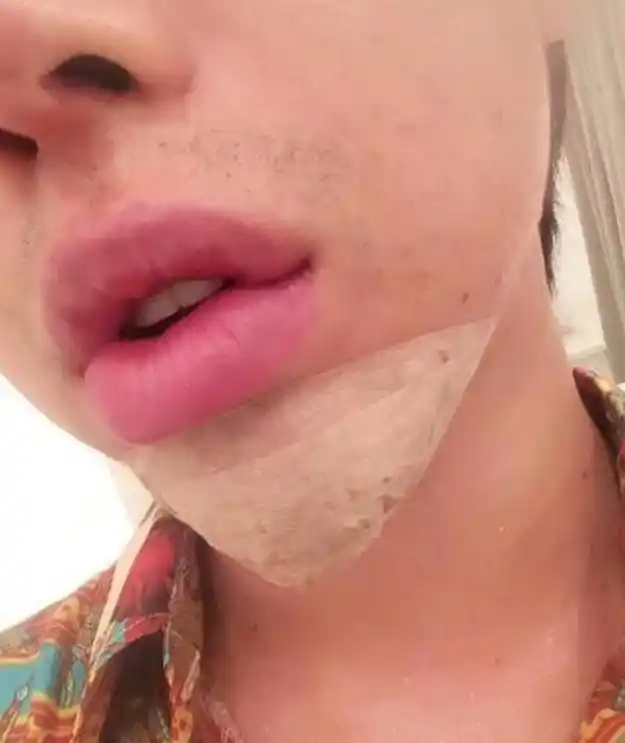 他被认为是日本整容次数最多的男人,他的整容费用不