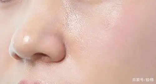 而且越油的皮肤,越容易毛孔粗大.