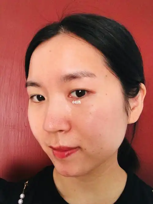 这是果酸换肤第6天的效果,效果很微妙,有一点点毛孔收缩,黑色素有一点