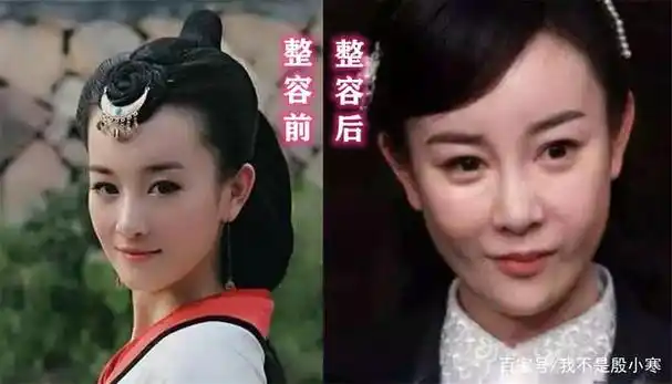 后悔整容的张檬以前有多灵|我就是演员