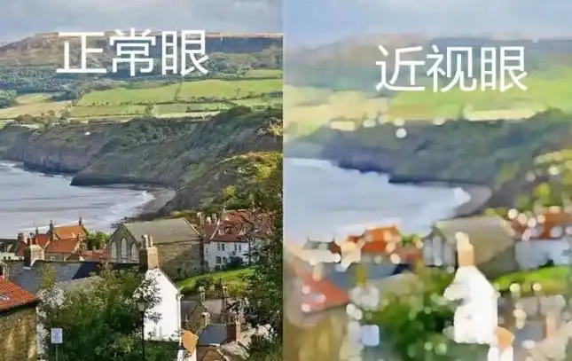 正常眼vs近视眼的世界五十米以外人畜不分什么鬼