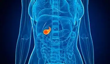 胆囊息肉的并发症有哪些 赵波营养师                    05-02