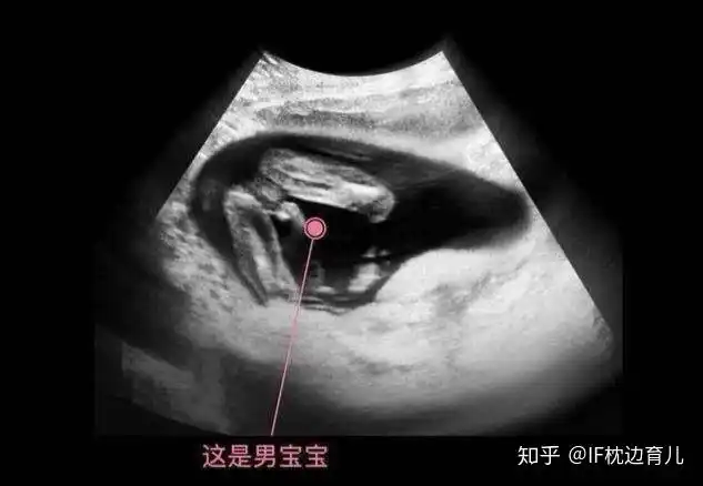 怀孕四个月胎宝宝会干什么呢来看看这些