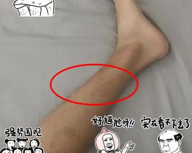 主要原因是千玺还在成长那几年,首次发现腿毛变长后,他在网络上晒出一