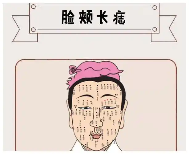 身体6颗巨富痣藏而不漏只要有一颗辈辈发家代代富