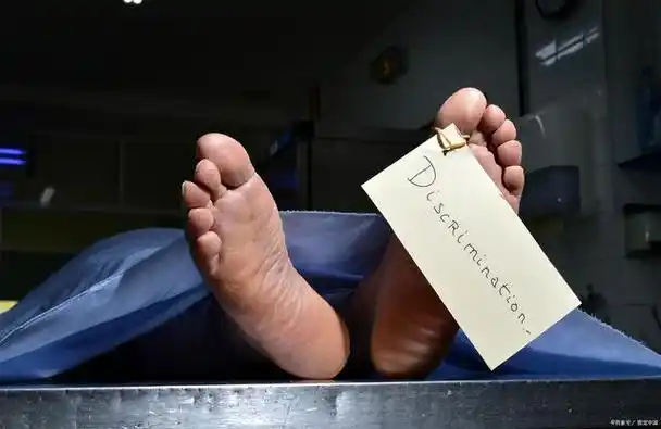 41岁男子尿酸750,并发尿毒症离世,提醒:4种蔬菜是"痛风"帮凶