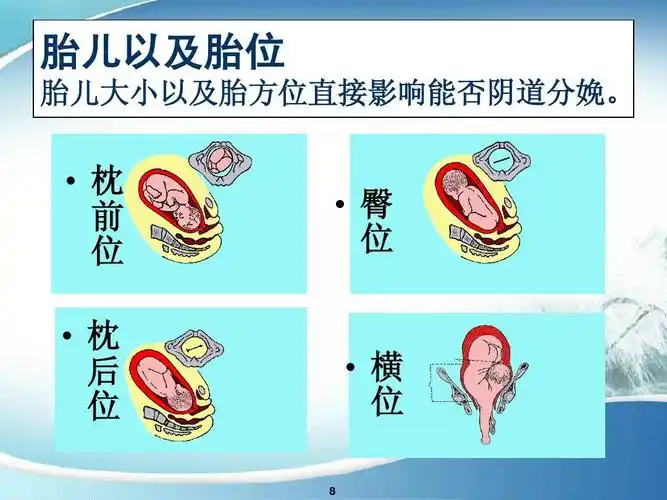 胎儿以及胎位 胎儿大小以及胎方位直接影响能否阴道分娩.