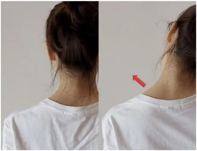 拉伸的时候斜方肌会被绷地更高)溜肩的改善溜肩的判断以颈根和肩膀