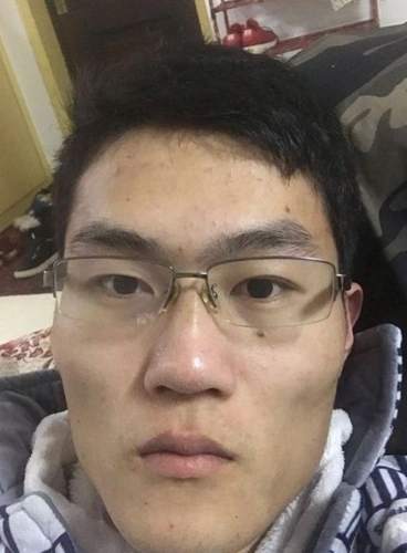 原创看相分析:大蒜头鼻中年大旺财运,印堂过宽被人欺骗感情