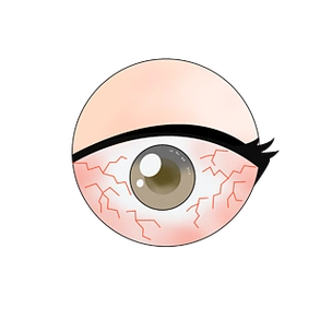 干眼症红血丝疲惫眼球眼健康卡通