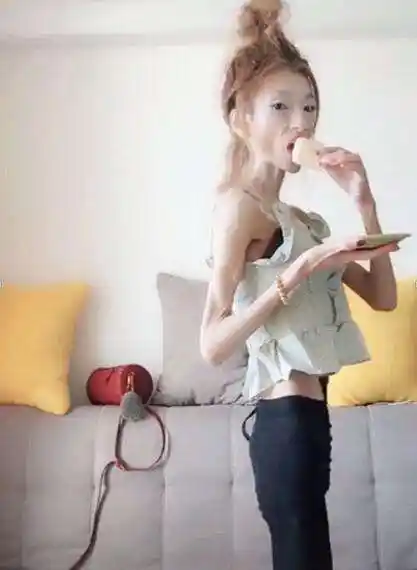 女子狂吃减肥药体重瘦到60斤成骷髅妹风大了不敢出门