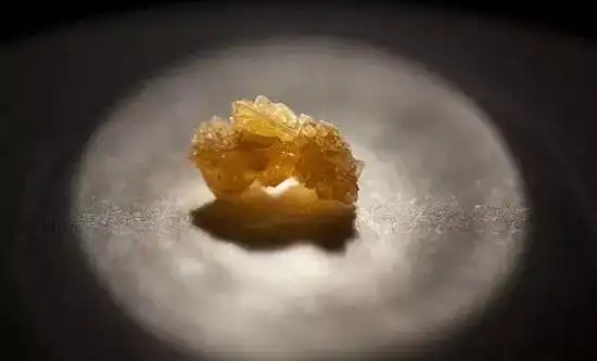 尿酸铵结晶的性状图