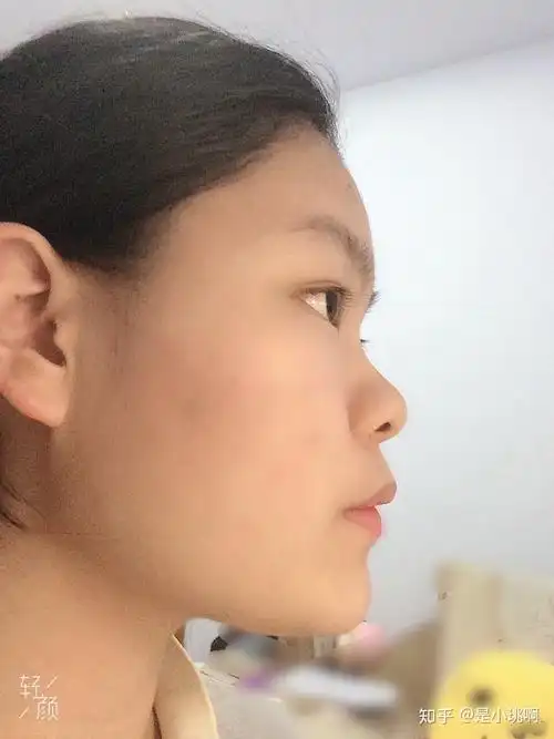 侧脸丑而正脸好看是一种什么体验