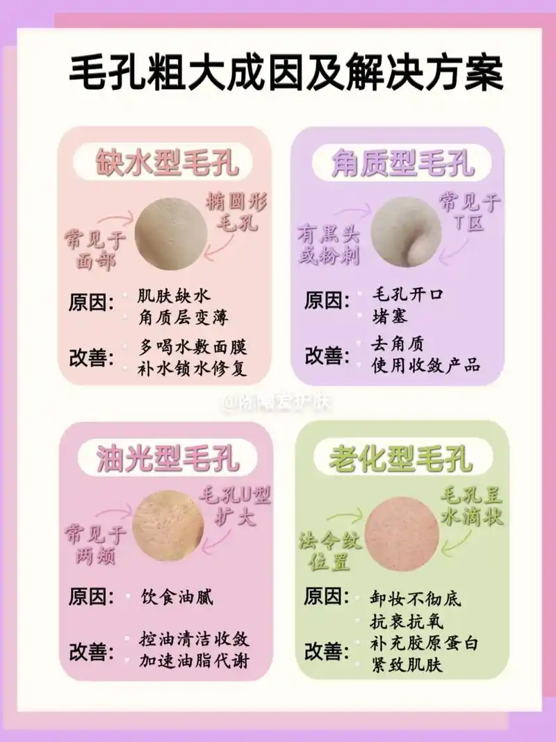 毛孔粗大多是由于毛孔堵塞 - 抖音