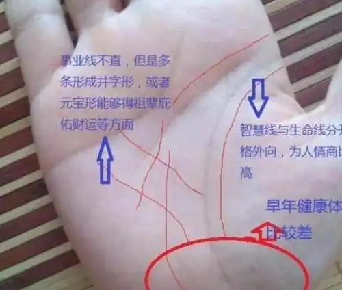手相生命线若出现三角纹十字纹必有大病的征兆需特别注意
