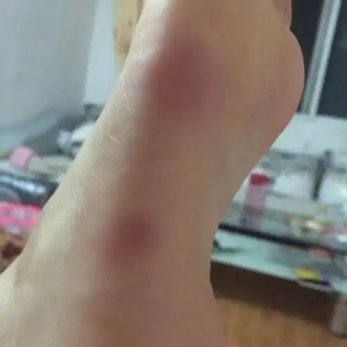 天气冷为什么脚底板疼(天气冷了脚底板有点麻刺疼)