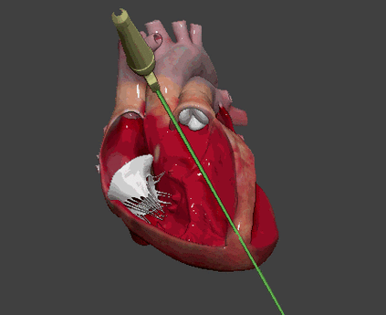 左室短轴切面3d图解心脏解剖与心脏超声切面