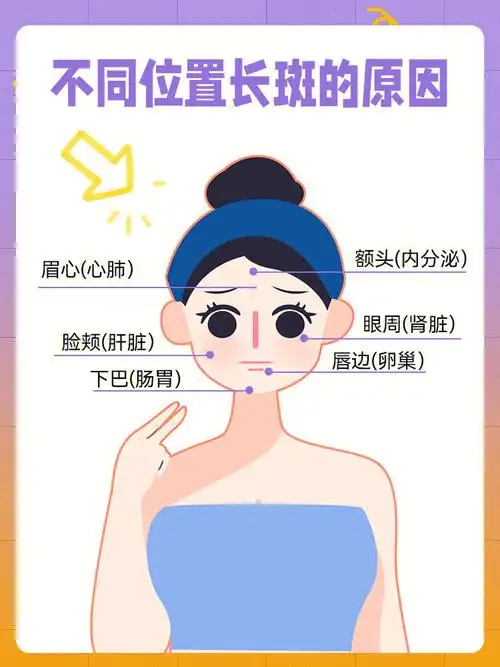 不同位置长斑其实是身体各器官的求救信号