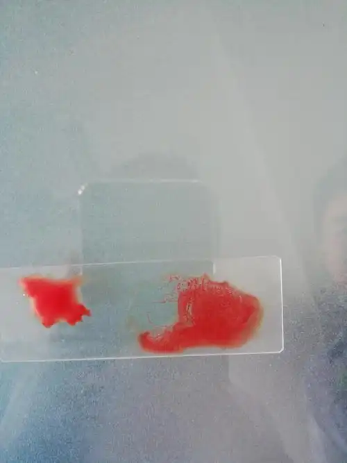 观察结果,左右分别滴的是抗b和抗a血清,发现右边出现凝集