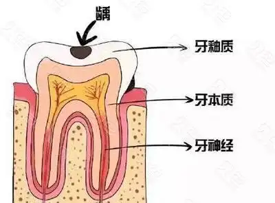 龙岩补牙哪里好,来这家补完牙齿就能咬苹果很厉害 - 贝色口腔