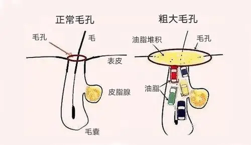 柏翠丝·收毛孔冰膜 | 敷一敷毛孔变细,皮肤更柔嫩