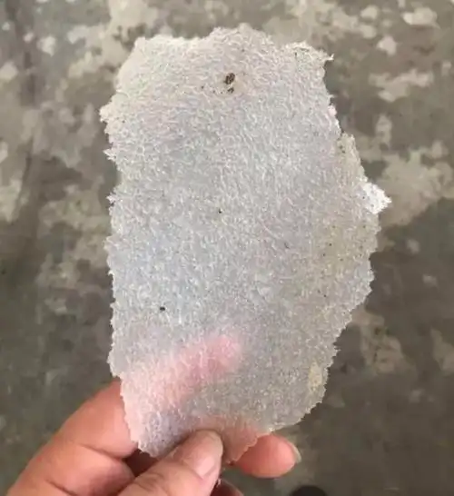 见过的最大头皮屑多大