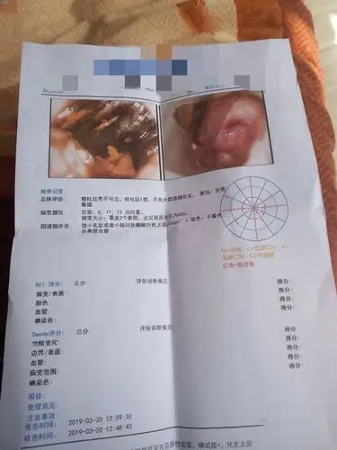 我妈妈的检测单,麻烦帮忙看下是不是宫颈癌?谢谢!