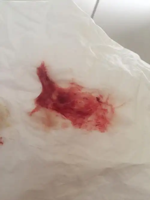 感觉下腹轻微坠痛.是排卵期.白带发黄,有血.无异味.