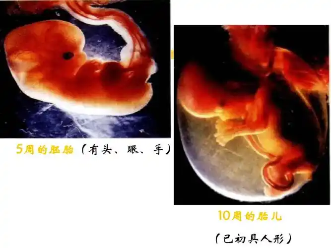 5周的胚胎(有头,眼,手) 10周的胎儿 (已初具人形)