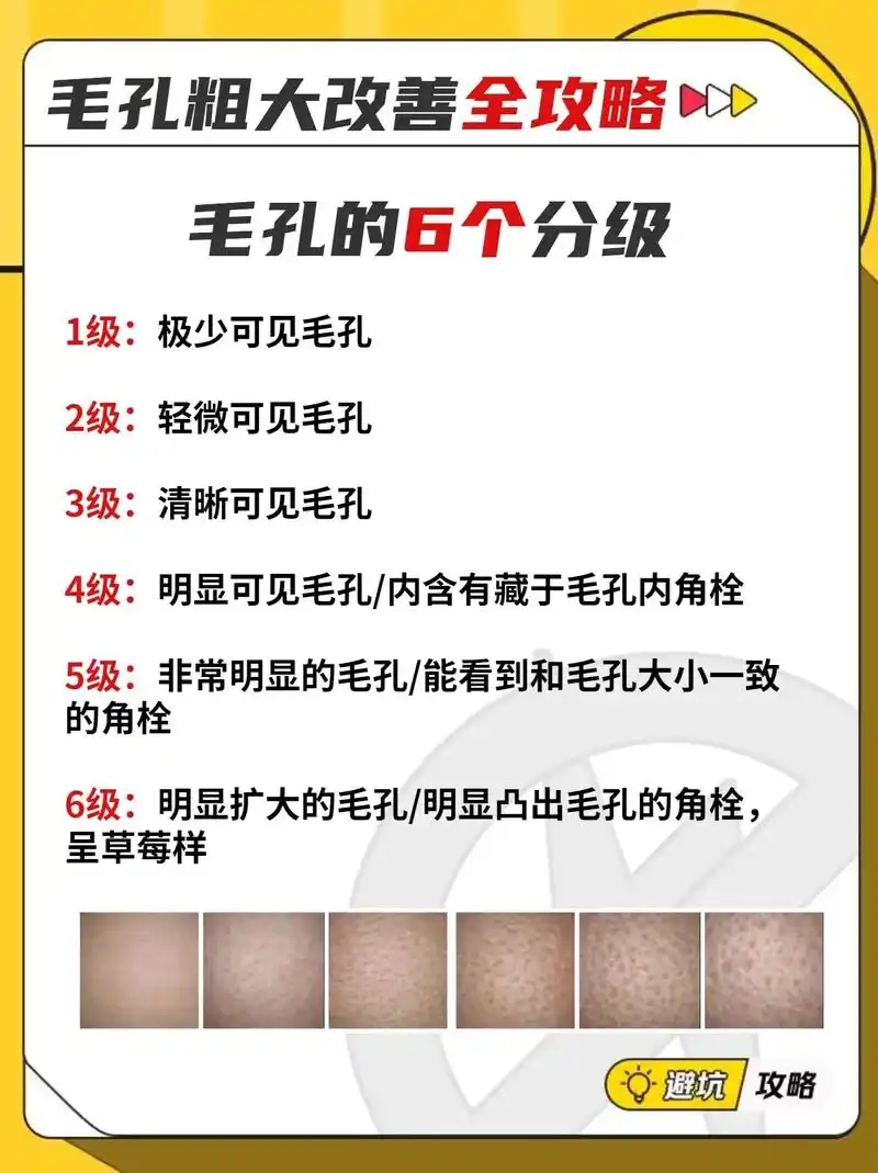 必看|毛孔粗大改善攻略!你的毛孔是那个级别?哪种类型?如何改 - 抖音