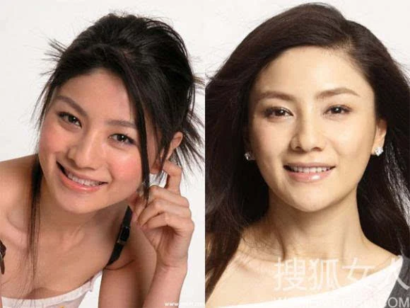 胡可——原来的下巴有些扁平,现在变的尖尖的很性感.