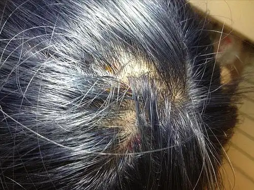 在三里屯染发,流血化脓头皮都烂了,有图!