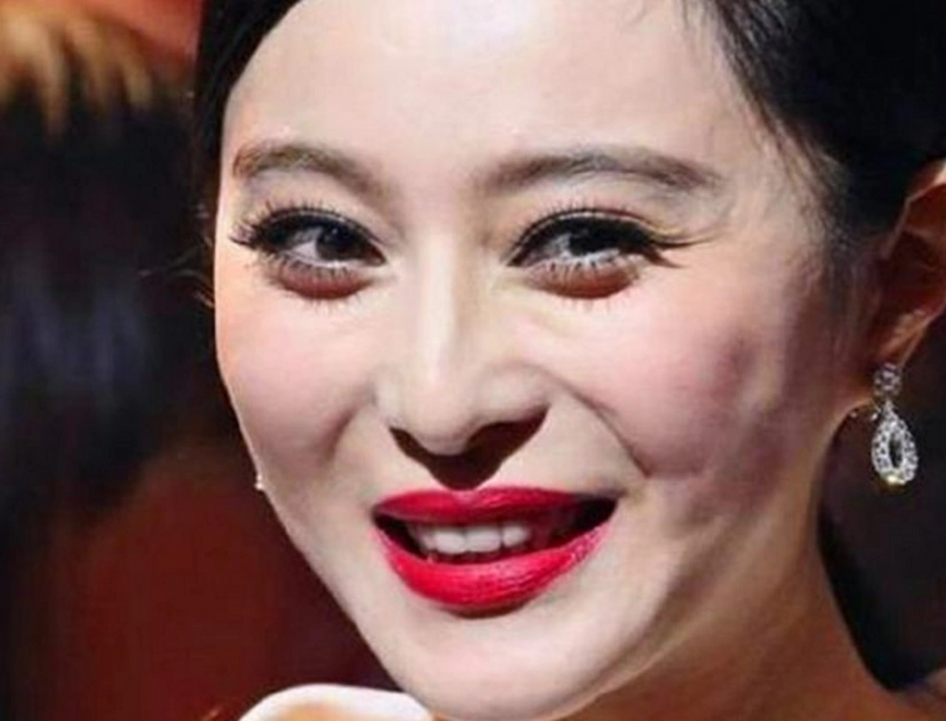 赵丽颖,天生丽质,虽然脸上有些小痘痘,但是女神也是人,这很正常,她不p