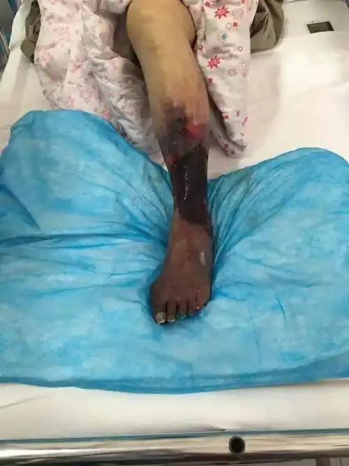 千里诊治一线牵,远程会诊助帮扶