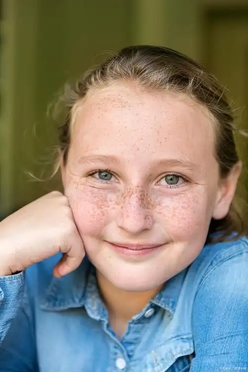 面部七种斑:了解斑点种类与应对方法