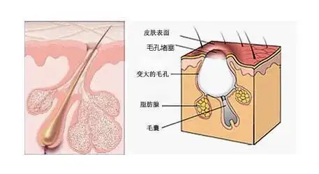 子雯护肤你知道你的毛孔健康吗