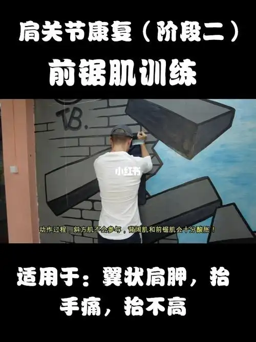 前锯肌训练适用于翼状肩胛抬手痛