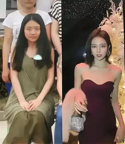 项思醒整容前照片曝光眯眯眼趴鼻梁大饼脸医生确实好技术