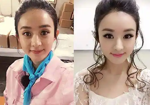 你有仔细观察过赵丽颖的额头吗?原来她也在发际线上动过手脚!