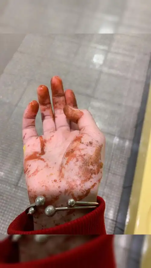 我这双被公认的"掏粪"人的手,实属凄凉060606