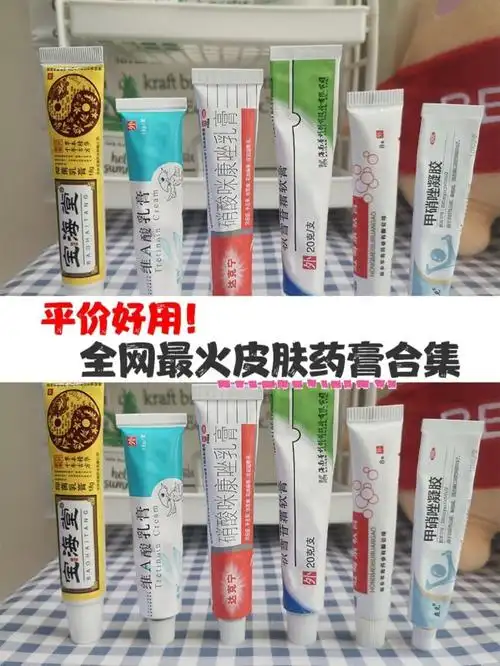 网红平价好用药膏合集 皮肤杂症看过来6015_乳液_药膏_红霉素软膏
