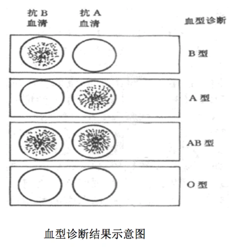 1 凝集反应–abo血型鉴定[目的]掌握凝集反应的定义及血型鉴定实验的