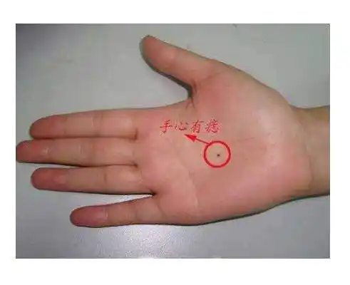 10,女人手心有痣