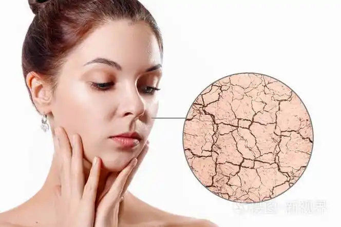 缩放圆圈显示干燥的面部皮肤在滋润之前. 护肤概念.