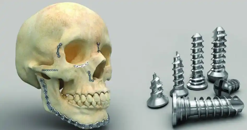 关注双创慈北医疗从手术台前抓创新灵感成就省级隐形冠军企业