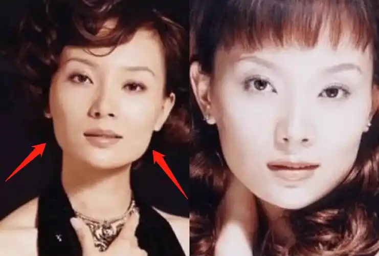 就必须要削骨,而削骨又会导致脸上挂不住肉,因此随着陈数年纪增长,她