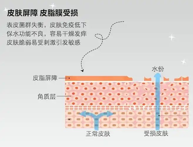 皮肤屏障受损该怎么修复