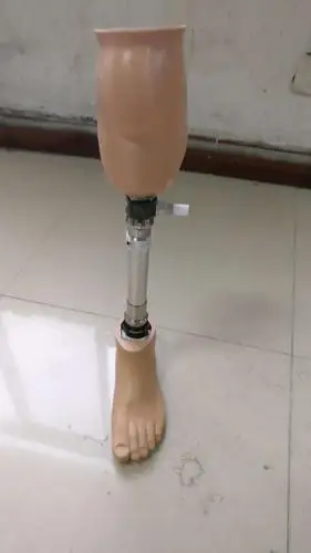 为小腿强直患者制作的硅胶套包膝假肢