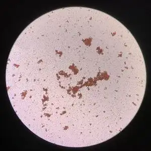 交叉配血试验中红细胞凝集不相容照片