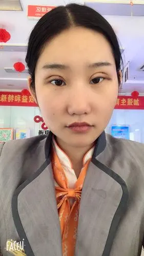 三点定位双眼皮第6天